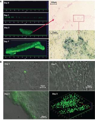 Effects of antibiotic treatment and phagocyte infiltration on development of Pseudomonas aeruginosa biofilm—Insights from the application of a novel PF hydrogel model in vitro and in vivo
